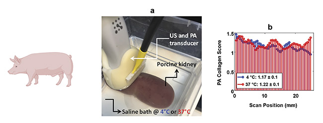 Figure 3. PA imaging can quantify collagen in clinically relevant temperatures. A photograph of the imaging setup (a). PA collagen estimates at two temperatures across multiple scan locations within the kidney (b). US: ultrasound. Adapted with permission from Reference 5.