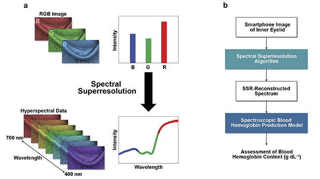 Figure 2. Statistical learning framework blood hemoglobin analysis using an mHealth algorithm. The concept of spectral superresolution (SSR) spectroscopy (a). The incorporation of the SSR algorithm and the blood hemoglobin prediction model for accurately and precisely quantifying blood hemoglobin content (b). Courtesy of Sang Mok Park and Young Kim.