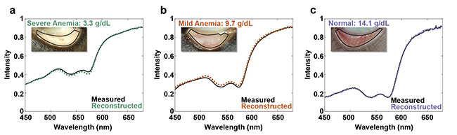 Figure 4. Representative SSR hyperspectral reconstruction for severe anemia with 3.3 g/dL (a), mild anemia with 9.7 g/dL (b), and normal condition with 14.1 g/dL (c). Courtesy of Sang Mok Park and Young Kim.