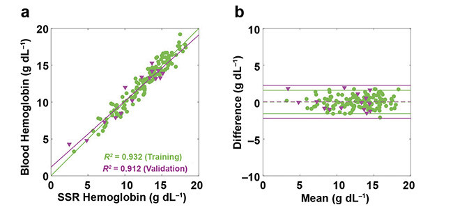Figure 5. Performance of SSR hemoglobin assessments using the mHealth algorithm. Correlations between clinical lab blood hemoglobin levels and computed levels of the training (138 individuals) and validation (15 individuals) data sets (a). Bland-Altman analyses between measured and computed levels (b). Courtesy of Sang Mok Park and Young Kim.