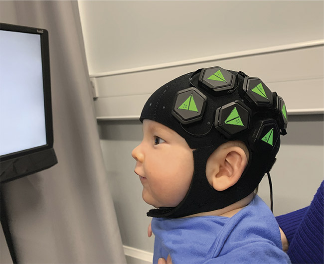 A baby wears a cap designed by scientists at Cambridge University to provide images of brain activity during development. Courtesy of Robert Cooper.