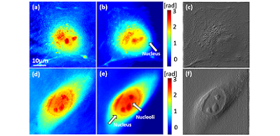 Synthetic Aperture Phase Microscopy Enables Subcellular Imaging