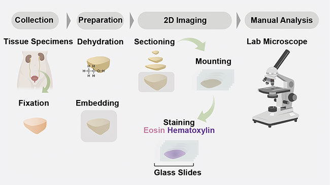 Figure 1. A schematic of a conventional 2D formalin-fixed paraffin-embedded hematoxylin and eosin (H&E) pathology workflow. Courtesy of A. Glaser/University of Washington Molecular Biophotonics Laboratory.