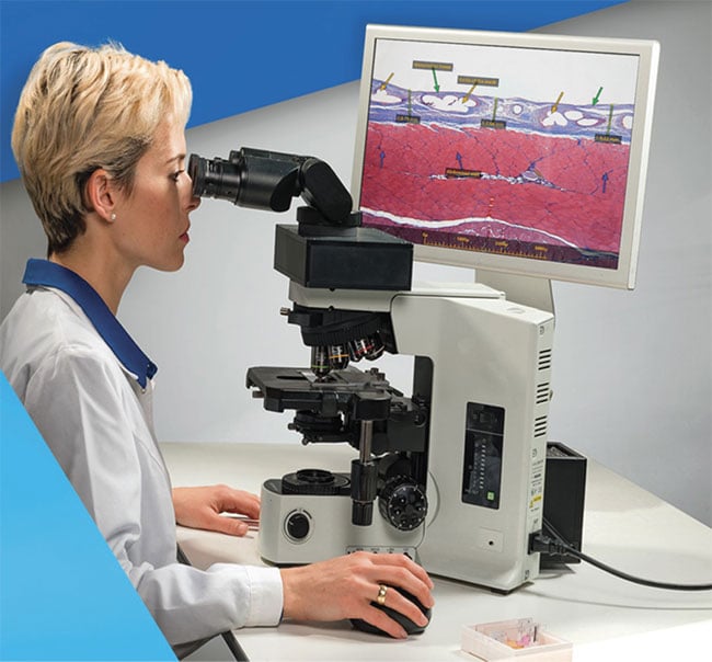 Figure 2. The electro-optical module is integrated within the existing light microscope. The pathologist interacts with the digital overlay via the computer mouse or other input device of her choice. The image of the specimen, as well as the AR overlay, can also appear on the computer screen. Courtesy of Augmentiqs.