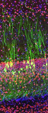 The winning image, captured by Ainara Pintor of Spain using a super resolution confocal microscope system The image shows the immunostaining of Thy1-EGFP mouse brain slice with two fluorophores. In green, the excitatory hippocampal neurons, which express Green Fluorescent Protein under Thy1 promoter. In red, Fat mass and obesity-associated (FTO) protein revealed with Alexa Fluor 594 antibody. In blue, cell nuclei labelled with DAPI. Courtesy of Olympus.