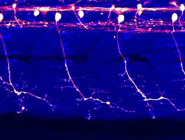 The whole cells of spinal motor neurons are visualized in an intact zebrafish larva (white/red). Skeletal muscles are shown in blue. Using optogenetics to study ALS. Courtesy of Kazuhide Asakawa.