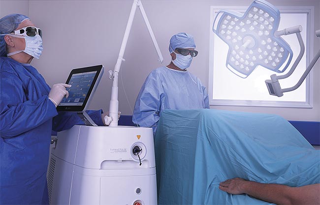 An all-in-one urology laser platform such as the MOSES technology can be used in the operating room to fragment stones throughout the entire urinary tract, targeting kidney, ureteral, and bladder stones. Modulated laser pulses ‘part the water’ by creating a small vapor bubble through which a consecutive laser pulse travels unimpeded to the targeted stone or tissue. Courtesy of Lumenis.