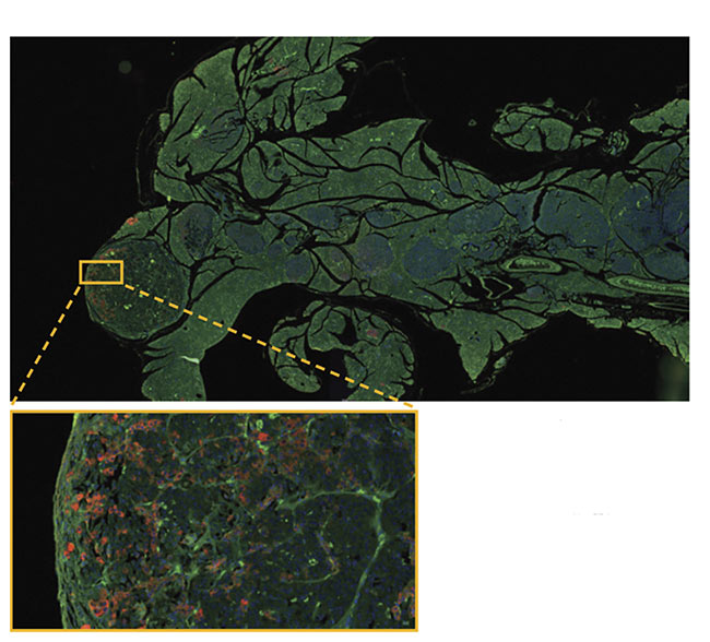 Pancreas stained with DAPI, GFP, and RFP. Courtesy of Rutgers Cancer Institute of New Jersey/ Wenjin Chen. 