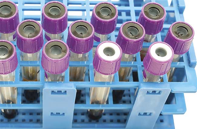 Blood sample tubes after analysis. Courtesy of iStock.com/chfonk.