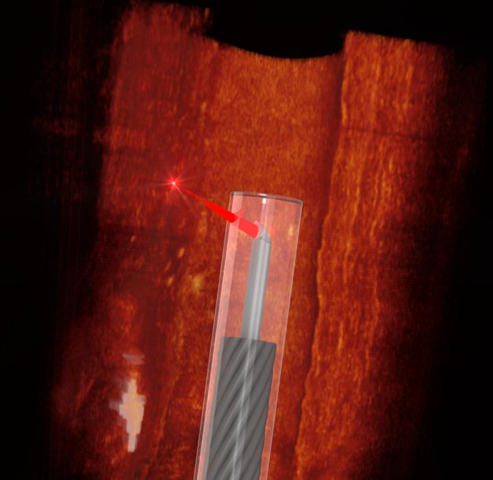 Ultrathin 3D printed endoscope imaging an artery. Courtesy of Simon Thiele and Jiawen Li.