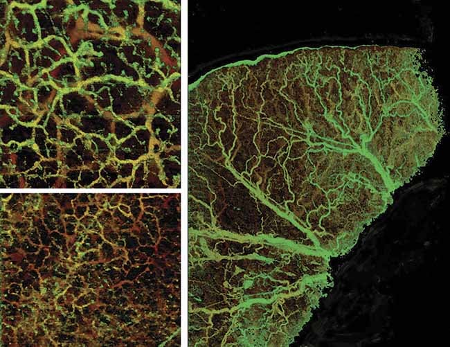 OCT angiography image of mouse skin using 800-nm and 1300-nm WP Microangio system. Courtesy of Wasatch Photonics.