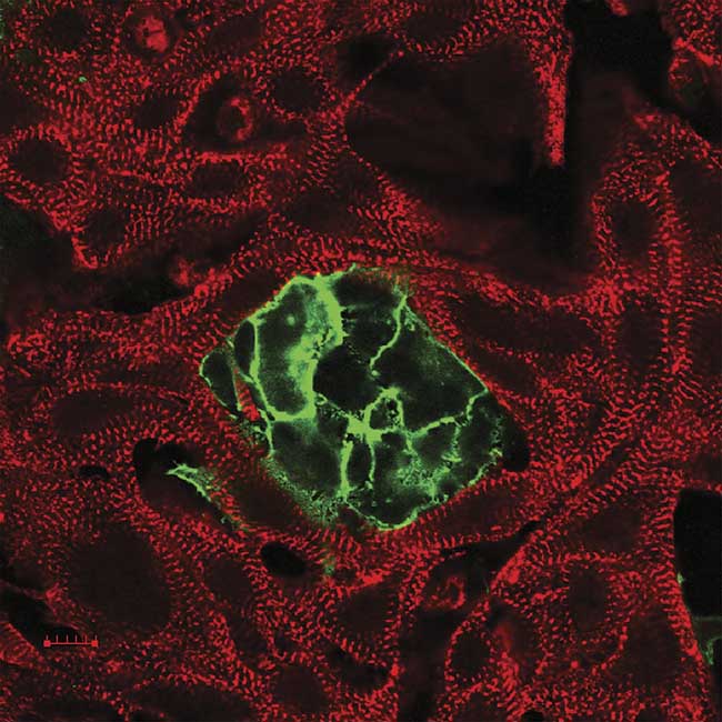 Heart cells (red) can be stimulated optically using interdispersed, dedicated, light-sensitive cells (green). Courtesy of Entcheva Lab. 