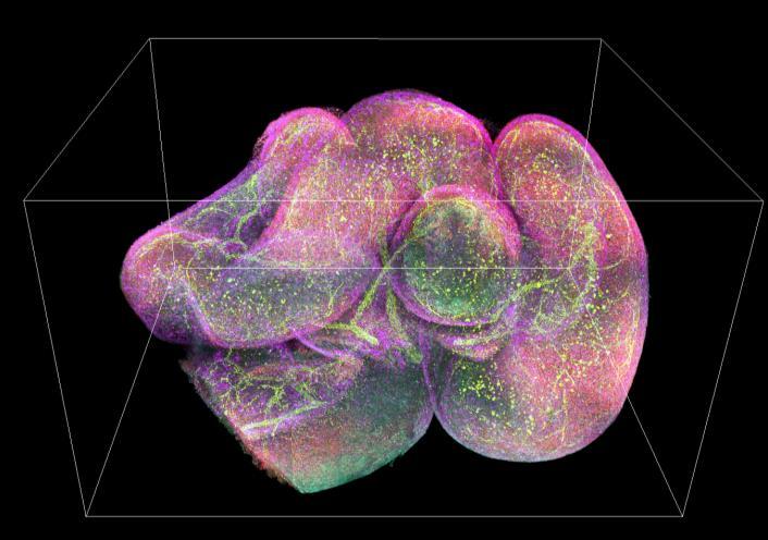 3D image of a mouse intestine with different antibodies in green, red, yellow, and purple. Courtesy of the National Institute of Biomedical Imaging and Bioengineering.