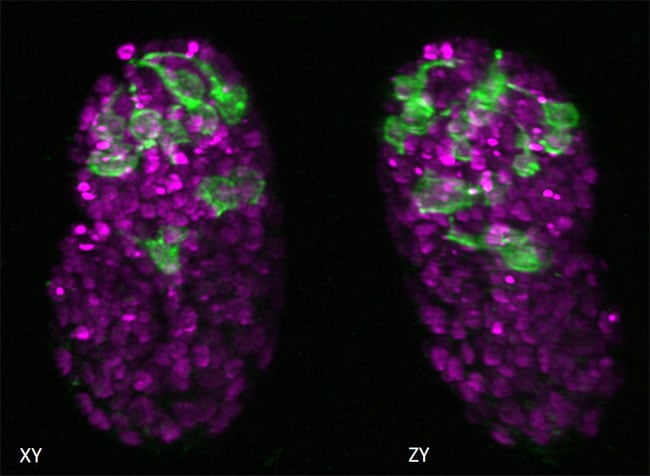 Lateral and axial images of C. elegans embryo expressing neuronal (green) and pan-nuclear (magenta) markers. Isotropic resolution enables lineage tracing and inspection of neurite outgrowth pre-twitching. Credit: L. Duncan and M. Moyle, Yale School of Medicine
