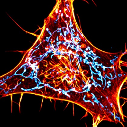 A cancer cell labeled for actin (red) and mitochondria (cyan). The scientists designed novel probes that specifically monitor interactions between actin and mitochondria. Courtesy of Salk Institute/Waitt Advanced Biophotonics Center.