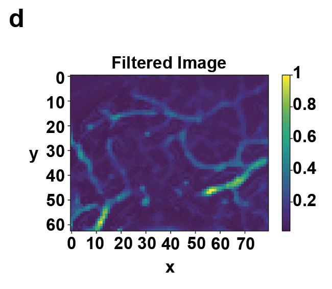 Figure 4. Tumor growth imaging in a live mouse thigh. 3D eTC-PCT amplitude image of the thigh with the right corner removed before tumor injection (a). Amplitude image of the thigh on day three after injection of the cancer cells in the tissue, revealing the penetration depth of the tumor (b). Amplitude image of the thigh nine days after injection of the cancerous cells (c) and 2D filtered image of the tumor on day nine, providing more details of blood vessels (d). On day three, tumor size is much smaller than on day nine. Image size: 1.35 × 1.08 cm; depth scale: ~2 mm. Courtesy of University of Toronto.
