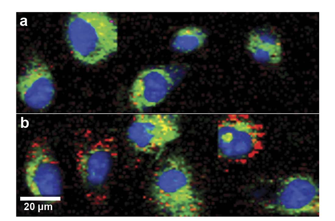 Figure 2. Raman imaging of human endothelial cells visualizes increased intracellular lipid storage (red) after treatment when comparing untreated control cells (a) to progesterone-treated cells (b). Images were color-coded according to the spectral components. Nucleus: blue; cytoplasm: green; lipids: red (c). Courtesy of AG Schenke-Layland/University of Tübingen.