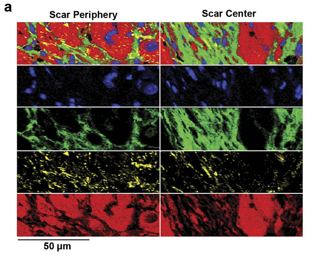 Figure 5. Analysis of fibrotic scar tissue in a section of heart muscle after myocardial infarction. Periphery and center of the fibrotic scar tissue were investigated using Raman imaging. As identified, based on the detected spectra, the scar tissue (green) is mostly composed of collagen fibers but also contains lipid vesicles (yellow). Moreover, distribution of cell nuclei (blue) and the striation of the heart muscle (red) was visualized (a). Corresponding spectral components (b). Courtesy of AG Schenke-Layland/University of Tübingen.