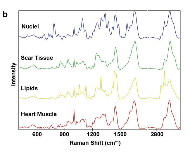 Figure 5. Analysis of fibrotic scar tissue in a section of heart muscle after myocardial infarction. Periphery and center of the fibrotic scar tissue were investigated using Raman imaging. As identified, based on the detected spectra, the scar tissue (green) is mostly composed of collagen fibers but also contains lipid vesicles (yellow). Moreover, distribution of cell nuclei (blue) and the striation of the heart muscle (red) was visualized (a). Corresponding spectral components (b). Courtesy of AG Schenke-Layland/University of Tübingen.