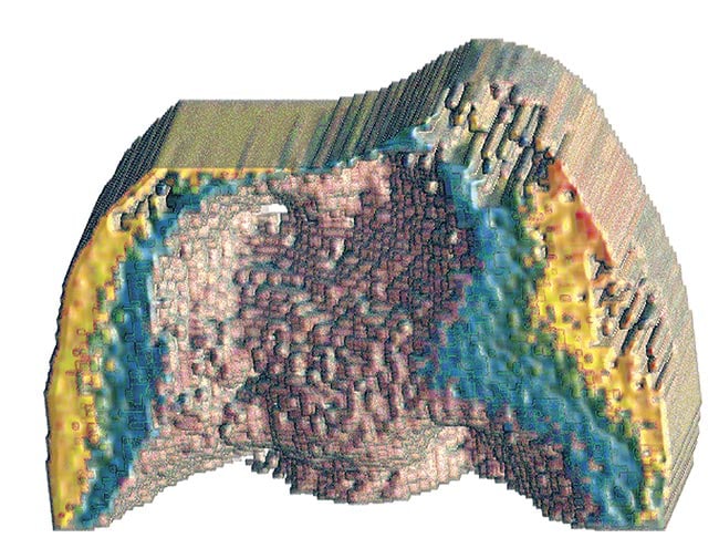 A reconstructed image of the distal surface of a tooth. Courtesy of University of Toronto.