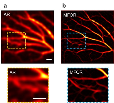 (a) AR-PAMER image. (b) MFOR-PAMER image. AR, acoustic resolution; MFOR, multifocal optical resolution; All scale bars, 1 mm. Courtesy of Caltech.