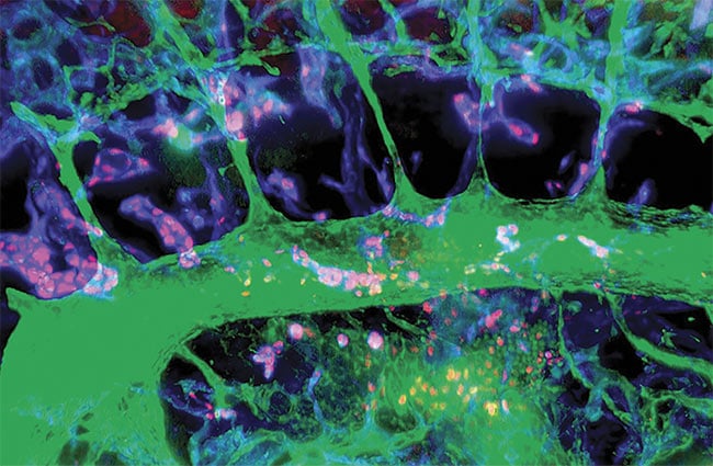 Lymph vessels of a mouse imaged by light sheet fluorescence microscopy, showing progenitor cells (pink), aorta (green), and vein (blue). Courtesy of Friedemann Kiefer, René Hägerling, and Cathrin Dierkes/EIMI.