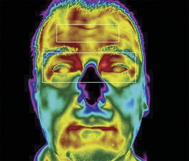 The inner canthi (i.e., the tear ducts) are the parts of the human face that correlate most closely to body temperature, and thermal camera systems designed for health screening applications should cover this area of the face with a minimum of 3 × 3 pixels, and ideally more. Courtesy of MoviTHERM.