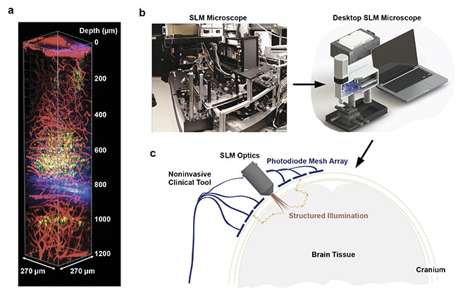 3D volume reconstruction of live mouse brain using three-photon imaging (a). A portable holographic microscope for potential multiphoton imaging in humans. A typical two-photon microscopy setup in a lab (b, left). An optically equivalent microscope that uses a spatial light modulator (SLM) to replace most of the optical elements (b, right). Depiction of an SLM-based microscope mounted on the skull for deep brain imaging (c). Image (a) reprinted with permission from Reference 10/CC BY-NC 4.0; (b) and (c) adapted with permission from Reference 6.