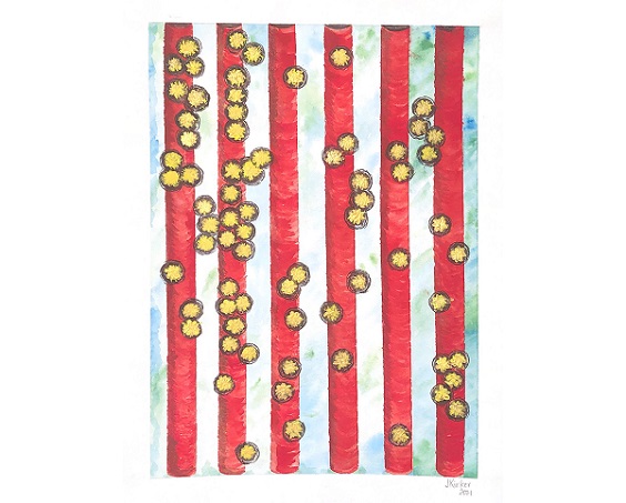 An artistic representation of gold nanoparticles on a photonic crystal surface. The optical coupling between plasmonic gold nanoparticle tags, and a photonic crystal surface, enable a photonic resonator absorption microscope developed by University of Illinois Urbana-Champaign research to provide contrast that is sufficient for the observation and counting of gold nanoparticles that are linked to proteins or other biomarkers. Courtesy of Janet Kirker.