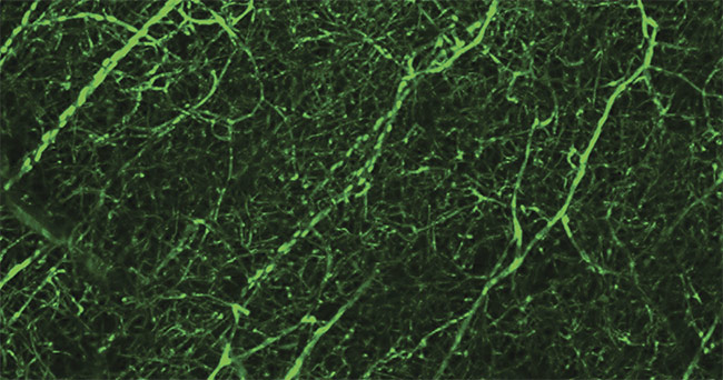 A two-photon image of mouse brain vasculature. Courtesy of Igno Schiessl/Manchester Bioimaging Facility.