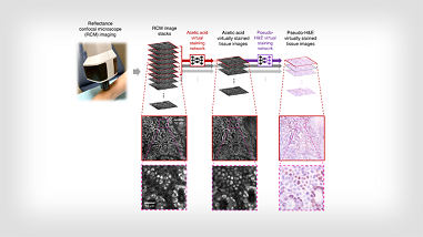 A UCLA team achieved biopsy-free virtual histology of skin using deep learning and RCM. The conversion of images obtained by noninvasive skin imaging to an hematoxylin and eosin (H&E)-like format could improve the clinician’s ability to diagnose pathological skin conditions. Courtesy of Aydogan Ozcan/UCLA.