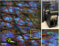 Image acquired in vivo at 60 µm depth from the forearm of a volunteer (A) by using the FLAME imaging platform (B). The macroscopic and the close-up images show collagen (SHG, blue) and elastin (TPEF, green) fibers, pigmented keratinocytes (TPEF, red) and hairs (TPEF,*).The 10 Mpx macroscopic image (2.5 x 3 mm2) was acquired in ~ 30 s. Courtesy of UC Irvine and Calmar Laser.