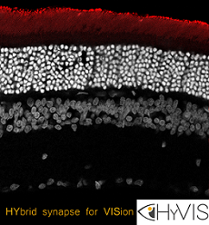 By combining nanotechnology and optics, the HyVIS project will develop bionic synapses for retinal prostheses, designed to restore sight in people suffering from diseases such as retinitis pigmentosa and age-related macular degeneration. Courtesy of IIT-Istituto Italiano di Tecnologia.