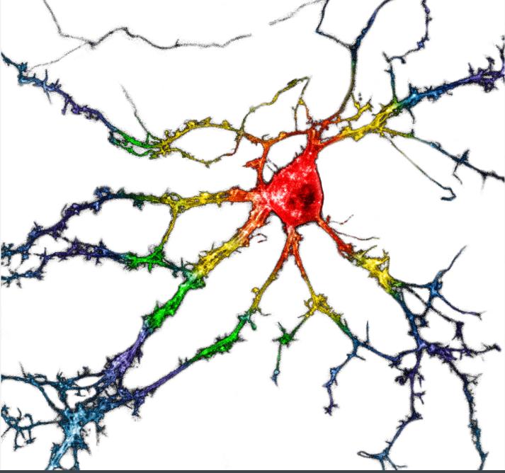 Dissociated neurons expressing psychLight. Courtesy of Chunyang Dong, Calvin Ly and Joanne Ly at UC Davis.