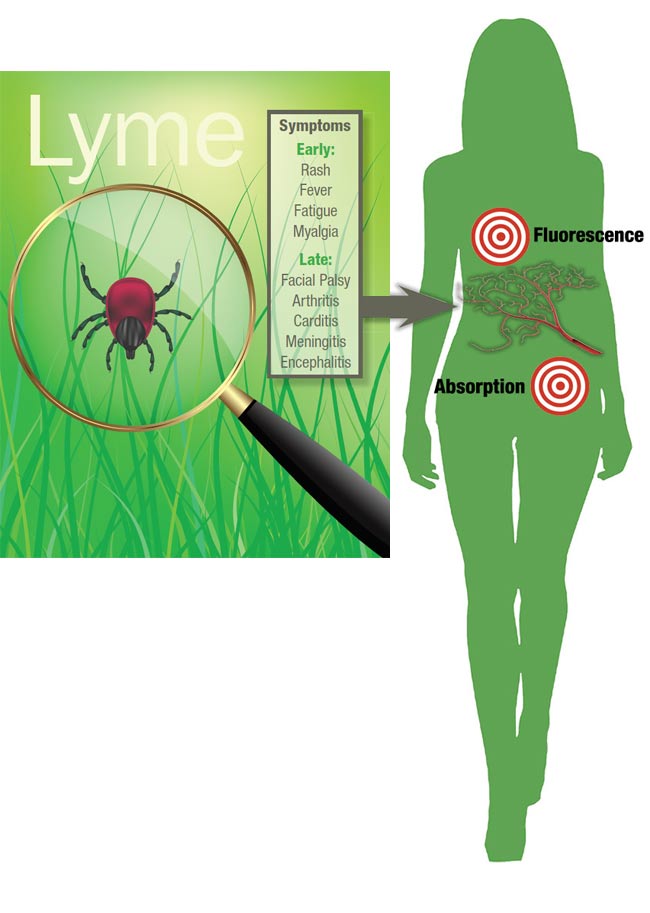 Figure 1. An illustrative interpretation of Lyme disease after contraction from a tick. Courtesy of iStock.com/Artsergei (magnifying glass and tick); iStock.com/msan10 (silhouette); iStock.com/Andrey Prokhorov (blood vessels); and iStock.com/FotografiaBasica (bull’s-eyes).