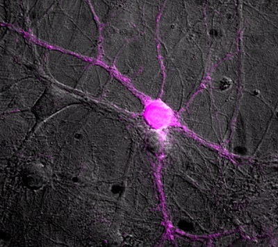 A neuron with its dendritic extensions expressing the mosquito-derived protein. Courtesy of the Weizmann Institute of Science.