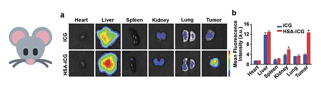 Figure 4. Ex vivo fluorescence imaging of nude mice bearing human breast cancer cell xenografts (MDA-MB-231-luc cell line), after intravenous administration of free ICG and human serum albumin (HSA) nanocarriers loaded with ICG (a). A semiquantitative assay of the fluorescence intensity measured for the same samples (b). Adapted with permission from Reference 4/Frontiers in Oncology.