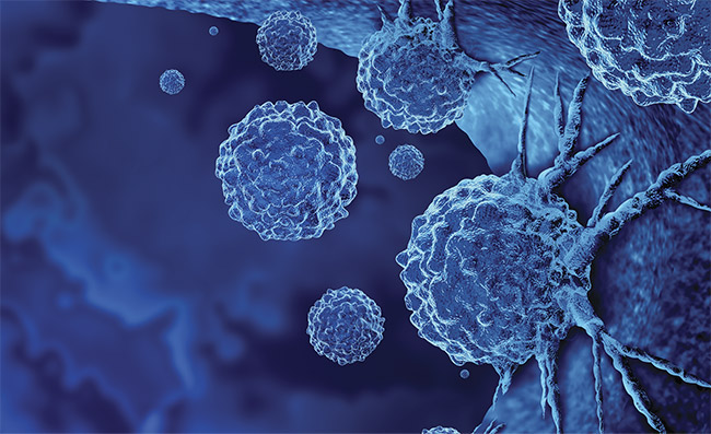 Cancer cells in the human body. Courtesy of iStock.com/wildpixel.
