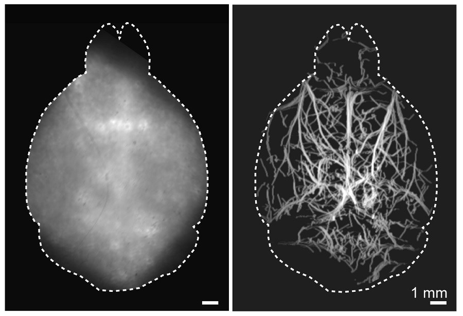 A new imaging method can capture images of vasculature deep in the brains of mice. A conventional widefield fluorescence image of the mouse brain taken non-invasively in the visible light spectrum is shown on the left, while the non-invasive localization-based DOLI approach operating in the NIR-II spectral window is shown on the right. Courtesy of Daniel Razansky, ETH Zurich and the University of Zurich.