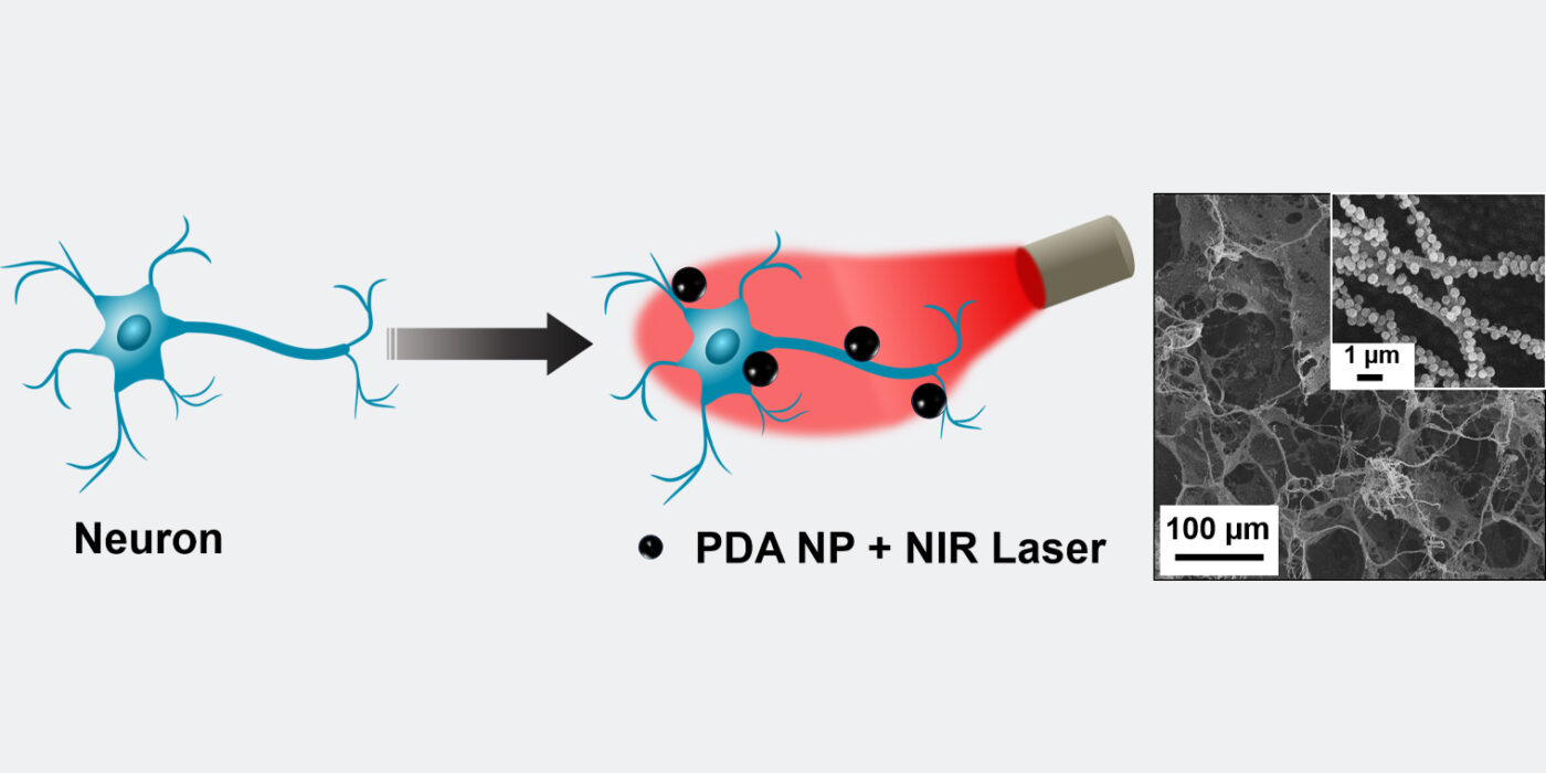 Schematic of polydopamine nanoparticle (PDA NP)-mediated photothermal stimulation of neurons. PDA nanoparticles localized on the neuron membrane (blue figure, left), modulate the neural activity through photothermal conversion of NIR light (red image, center). On right: Scanning electron microscopy (SEM) image of neurons on electrode (inset: higher magnification SEM). Courtesy of Washington University in St. Louis/Srikanth Singamaneni.