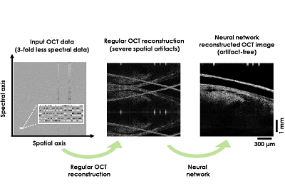 Deep learning improves image reconstruction in optical coherence tomography using significantly less spectral data. Courtesy of the Ozcan Lab at UCLA.