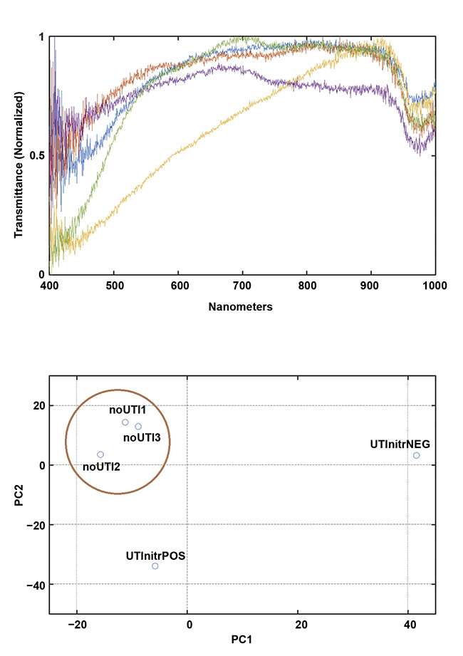 Figure 2. Early data demonstrates the feasibility of collecting meaningful spectra in a clinical setting using a portable device. Transmission spectra (top) and a principal component analysis (PCA) plot showing clustering of the negative (NEG)/normal cases (bottom). Courtesy of Rajagopal Srinivasan.