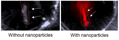 A new imaging technique uses nanoparticles to help reveal vulnerable plaques in arteries that can lead to strokes and heart attacks. Immune cells in the plaque attract the nanoparticles, which can then emit a signal that’s seen in red in the image on the right, taken from a mouse artery. That signal is absent &mdash; meaning a plaque goes undetected &mdash; in the artery shown on the left, which shows a mouse that did not receive the nanoparticles. Courtesy of Advanced Functional Materials.