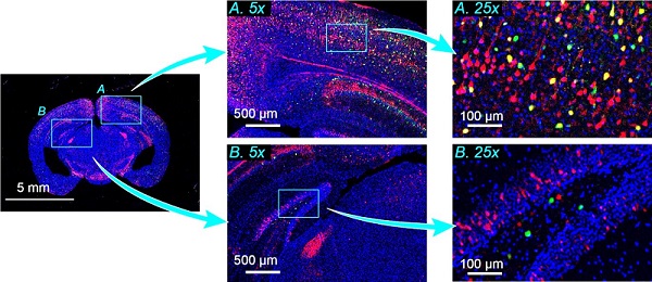 A multicolor image of a mouse brain slice with two regions indicated by light blue squares, namely, the cerebral cortex (A) and the hippocampus (B). These are displayed in the whole-brain image (left) and digitally magnified 5× (middle). The local regions of light blue squares in the 5x images are further digitally magnified five times (right). Red, green, and blue represent the fluorescence due to a red fluorescent protein expression in excitatory projection neurons, a green fluorescent protein expression in inhibitory interneurons, and Hoechst 33342 attached to nuclear DNA, respectively. Courtesy of T. Ichimura et al., Scientific Reports.