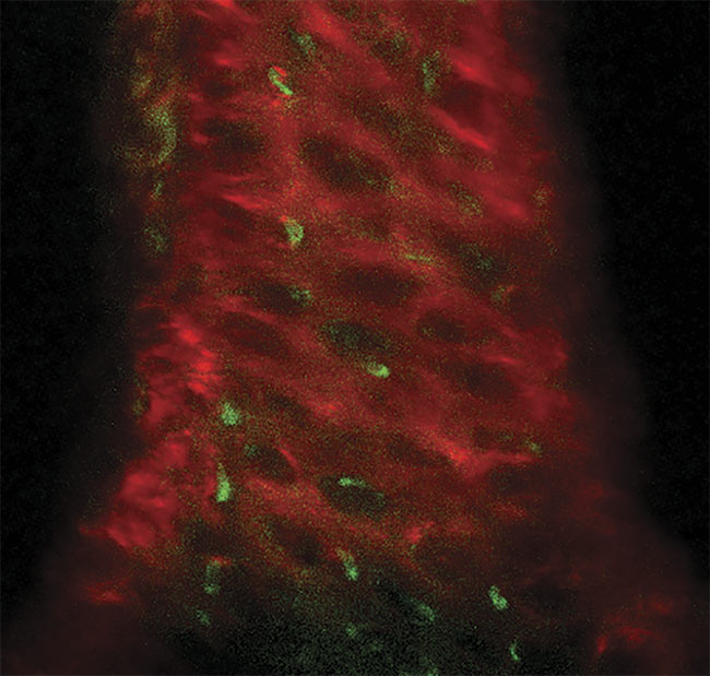 A three-photon image of an ex vivo mouse sternum, taken 200 µm deep using the HyperScope imaging system. Second-harmonic generation (SHG) from the bone structure (red) and three-photon excited eGFP (enhanced green fluorescent protein)-labeled nestin-positive cells (green). Courtesy of Dr. Tobias Ackels/Francis Crick Institute.