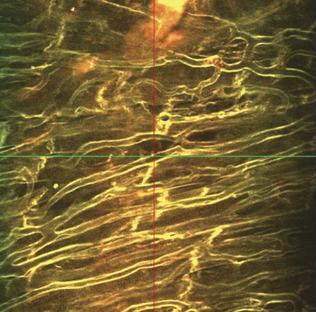 Results acquired when imaging with a fixed-wavelength laser source. Multimodal imaging in which liver cells overlaid by collagen tissue can be differentiated using mT:mG as a marker within the liver cells (red) and an SHG signal from collagen fibers (blue) (top). Ex vivo z-stack imaging at the epicardial surface of a mouse’s left ventricle, in which the tissue is stained with di-4 ANEPPS (bottom). Cardiac tissue could be imaged at depths of 250 µm. Courtesy of Institute of Genetics and Molecular Medicine/University of Glasgow.