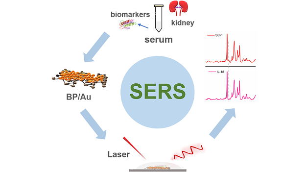 Researchers have developed a new SERS method to detect biomarkers related to kidney injury in blood serum or urine. The highly sensitive approach could one day offer a more accurate way to evaluate the quality of kidneys before transplantation. Courtesy of Hui Chen, University of Shanghai for Science and Technology, and Mingxing Sui, Changhai Hospital of Shanghai.