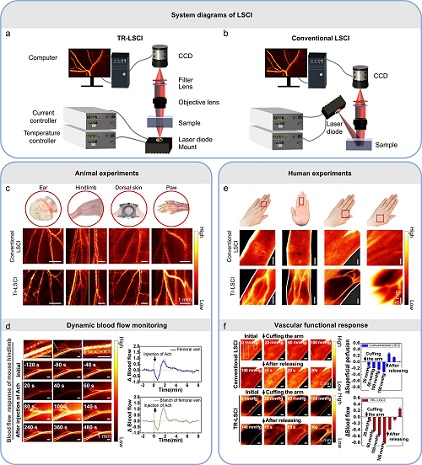 (a): A diagram of the TR-LSCI imaging system. (b): A diagram of the conventional reflective-detected LSCI system. (c): A comparison between TR-LSCI and conventional LSCI for cutaneous/subcutaneous blood flow mapping on different parts of the mouse body. In (c), it is obvious that TR-LSCI provides better imaging quality for each body part, especially for the thick parts. (d): TR-LSCI for dynamic blood flow monitoring in the mouse hindlimb after an acetyl choline (a drug that dilates blood vessels) injection. TR-LSCI was capable of distinguishing individual cutaneous blood vessels. The plots in (d) represent the dynamics in the femoral vein and in the branch of femoral vein, showing that, compared to the femoral vein, the blood flow velocity in the branch of the femoral vein responded more strongly but recovered more quickly. (e): A comparison between TR-LSCI and conventional LSCI for subcutaneous blood flow mapping on different parts of human hands. As shown in (e), the blood flow in the individual blood vessels was resolvable in TR-LSCI, while conventional LSCI was not able to distinguish it. (f): Conventional LSCI and TR-LSCI for reactive hyperemia experiments on human hands. Conventional LSCI was used to monitor superficial perfusion, while TR-LSCI was used to monitor blood flow in the deep vessels. The histograms in (f) represent the dynamics in the superficial perfusion and deep blood flow. The results suggest that blood flow in the deep larger vessels is affected by pressure more and recovers more slowly after pressure is released. Courtesy of Dong-Yu Li, Qing Xia, Ting-Ting Yu, Jing-Tan Zhu, and Dan Zhu.