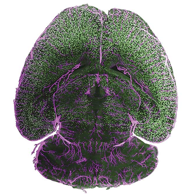 Figure 1. A cleared mouse brain. The image was taken with an Iris 15 sCMOS camera on a benchtop mesoSPIM (mesoscale selective plane illumination microscopy) light-sheet system. The sample was stained for amyloid beta plaques (green) and arteries (magenta) and prepared by Anna Maria Reuss at University, Hospital Zürich. Courtesy of Teledyne Photometrics.