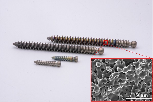 Titanium orthopedic screws shown with and without antimicrobial silver nanoparticle coatings. Inset shows an electron microscopy image of the nanoparticle coating applied using a laser-assisted immobilization process. Courtesy of Rahim Rahimi.